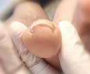 この爪どうやって切ったらいいの？その疑問に答えます 爪のトラブルお任せください！！ イメージ2