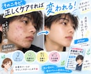 皮膚科ナースがニキビ、肌荒れのご相談のります 繰り返すニキビ一緒に原因を整理しませんか。特典付き♡ イメージ2