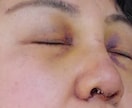 美容整形した方がいい場所教えます 美容整形、どこをしていいのか？悩んでる方。 イメージ1