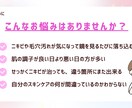 韓国美人肌を手に入れるアドバイスをお伝えます 汚肌人生から逆転、モテ肌を手に入れたい方へ イメージ2