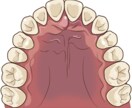 お口の中の相談（虫歯や歯周病など）何でも承ります 歯医者でなかなか聞けない質問なんでもお気軽にどうぞ！ イメージ3
