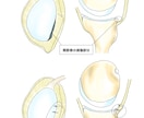 整形外科専門医が医療イラストを描きます 論文用シェーマや患者説明用イラストなどに！ イメージ8