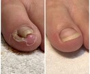 サロン向けです⭐️病的トラブルへの対策を伝授します お客様やあなたのリスクヘッジの為にレベルアップしませんか❓ イメージ3