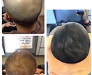 髪の悩みを解決します あなたが気になっている薄毛の悩みご相談下さい！ イメージ8