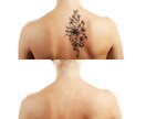 【画像修正・ レタッチ】Tattoo(刺青)・アザ・手術痕などを消去♪ イメージ1