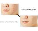 プロフォトグラファーが画像編集・レタッチ致します 低価格・対応・スピード、自信あり。 イメージ1
