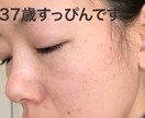 スキンケアの引き算教えます たるみ、くすみ、乾燥解消スキンケアアラフォーアンチエイジング イメージ1