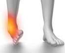 足関節捻挫のプロトコルを提供します 全トレーナー・治療家の為の知っておくべき足関節捻挫プロトコル イメージ1