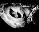 エコーにて最速妊娠6週からの性別予測をします 産婦人科、超音波専門医がラムジーメソッドにて性別予測！ イメージ1