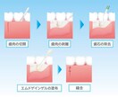 分かりやすい！伝わる！図解・解説イラスト制作します 整形外科・歯科・美容外科様など様々な図解イラストを作成 イメージ5