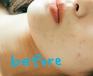 ポートレート写真の肌レタッチをします アドビで粗を"消す"のではなく、肌を"描く"サービスです イメージ1
