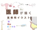 伝わる医療用のイラストを作成します グラフィカルアブストラクト、論文で使うイラスト イメージ1