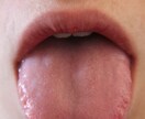 専門歯科医師: お口・舌の痛みや痺れのお話聞きます 舌痛症、口腔乾燥症(ドライマウス)などの専門外来担当医が担当 イメージ1