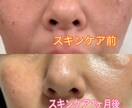 最近の美肌術を教えます あなたの肌に1番適した化粧品、お手入れ方法を教えます！ イメージ4