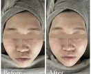 頭蓋骨小顔コルギ教えます すぐ実践1回習得コース（経験者や知識ある方におすすめ） イメージ1