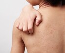 アレルギー克服体験からアトピーの治し方を提供します 薬を使わず、原因は何か。常識を疑い・食生活改善を提案します。 イメージ7