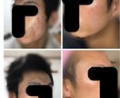 現役美容看護師があなたを美肌に導きます 数十万の契約で後悔する前に！現役看護師が中立にアドバイス イメージ1
