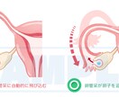 医療・看護・教材イラスト ポップな絵柄で制作します 健康フィットネス系、筋肉・骨格・臓器、医療器具etc… イメージ7