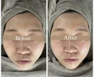 小顔コルギのセルフケア教えます 現役エステティシャンが教える圧倒的小顔セルフケアを教えます！ イメージ3