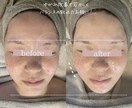 頭蓋骨小顔コルギの技術全て教えます 戻りにくい小顔技術を現役エステティシャンが全て教えます イメージ1