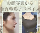 顔写真から美容整形コンサルをさせていただきます 美容整形について私の整形経験を基にアドバイスします！ イメージ1