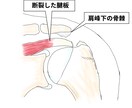整形外科専門医が医療イラストを描きます 論文用シェーマや患者説明用イラストなどに！ イメージ7