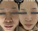 美容初心者大歓迎♪お肌の悩み相談お受けします 【美容初心者必見】流行のオンラインエステで店に足を運ばず綺麗 イメージ2