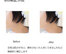 データ納入ウェルカムボード作ります 肌にお悩みで結婚式で最高の自分を見せたいあなたに イメージ8
