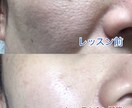 最近の美肌術を教えます あなたの肌に1番適した化粧品、お手入れ方法を教えます！ イメージ3