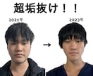イケメンになる方法教えます イケメンな見た目を手に入れる方法です イメージ1