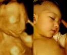 AIでエコー写真から赤ちゃんのお顔を予測します 未来の可愛いお顔を先取り、ワクワクが止まらない イメージ1