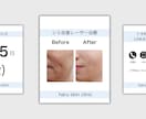美容クリニック向けSNS投稿デザイン作成します 清潔感のあるデザインで施術紹介・お知らせに最適 イメージ1