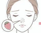 頑固な肌トラブルの解決法教えます どんな事をしても肌トラブルが治らない方へ イメージ1