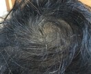 髪の毛を生やす方法を教えます 薄毛で悩んでいる方、髪を生やしたい方 イメージ2