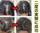 男性限定⚠️薄毛を改善させる方法をご提供いたします メンズの薄毛を徹底改善✨9割の増毛効果の実績✅ イメージ2