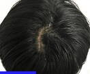 薄毛改善の方法を教えます 申し訳ありません...これでダメならもう元には戻せません イメージ2