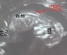 周産期、超音波専門医がエコーの確認、解説をします これはなにを見ているのかなど、胎児エコーを詳しく解説。 イメージ2