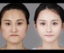 現役美容カウンセラーが美容外科の裏側教えます 本当に効果がある施術！ダウンタイムや金額のお悩み解消します！ イメージ1