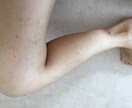 アレルギー克服体験からアトピーの治し方を提供します 薬を使わず、原因は何か。常識を疑い・食生活改善を提案します。 イメージ10