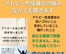 アトピー性皮膚炎の悩みを聞きます 僕自身もアトピーを持っていますので、なんでもお話してください イメージ1