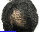 薄毛がグングン改善するとっておきの技法を教えます 頭頂部への気になる目線よ サヨウナラ！ イメージ4