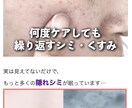 集客購買用の記事LPをまとめて3本ドカッと書きます アドアフィなど対応、ライティングはやはりプロに任せましょう イメージ5