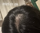 抜毛症専門！あなたの苦しみに寄り添います 私の経験談を詳しくお話します。 イメージ4