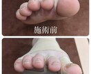 足から全身代謝を上げる足テーピングをお伝えします 足の歪みは全身の歪みとなり代謝不良に。足テーピングレクチャー イメージ1