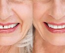 写真を自然な感じに、合成・修正・レタッチします Photoshopレタッチ作業全般 イメージ2