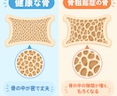 骨粗鬆症マネージャーが骨密度・健康相談にのります 検査結果の見方や生活習慣のアドバイス、病院で聞けなかった事も イメージ1