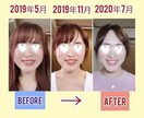 オンライン結婚式【小顔画面映えする】小顔を作ります メスを入れず自宅で整形級レベルの小顔を作る！ イメージ3