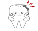 歯が痛い！しみる！ご相談お受けします 最近歯が痛い、歯がしみる、虫歯か心配、歯医者に行くべき？ イメージ1