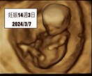 4Dエコーを自然に可愛く修正orイラスト化します 産婦人科専門医が4Dエコーをわかりやすく修正します。 イメージ1