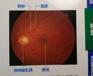 目の事で聞いてみたい事ありませんか？お答えします 眼科に行ったけれど 説明がよくわからなかったりしませんか？ イメージ6